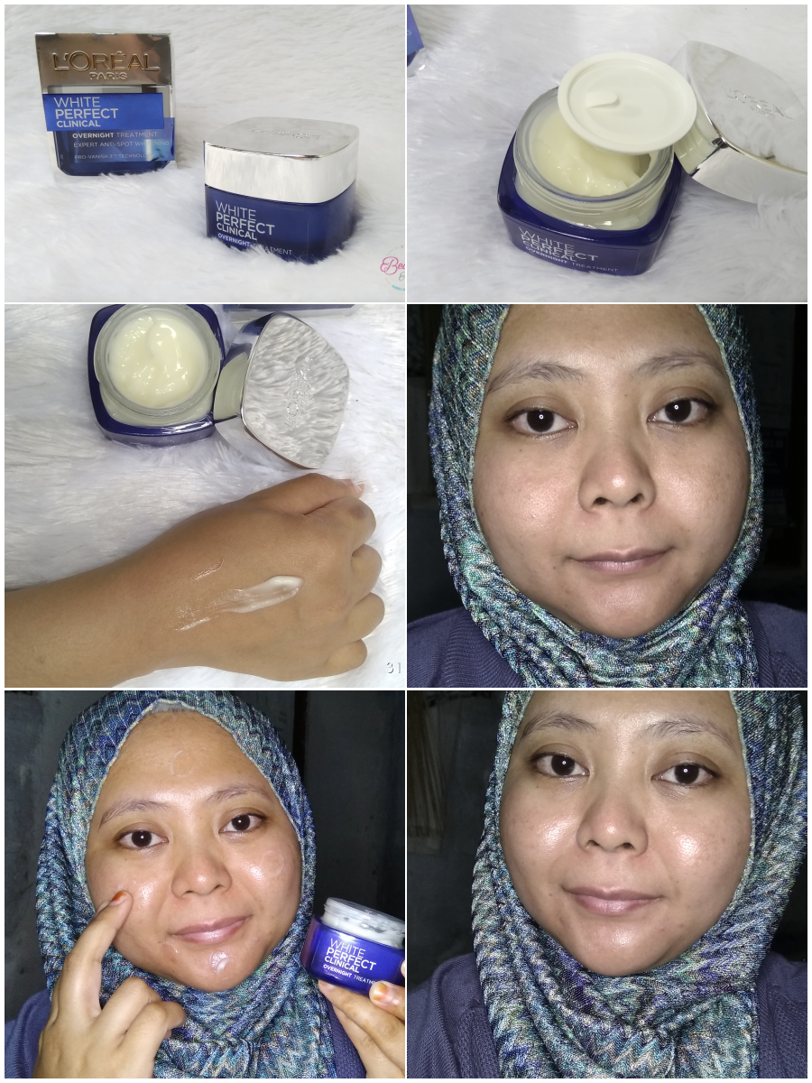 testimoni loreal white perfect