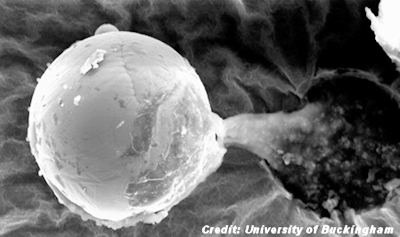 Picture of Alien Seed? Scientists Discover Mysterious Organism 1-24-15 