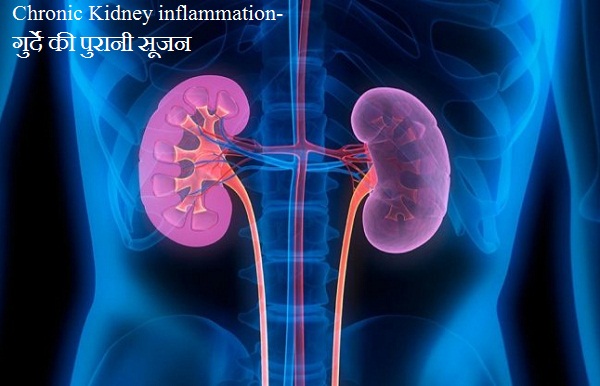 Chronic Kidney inflammation