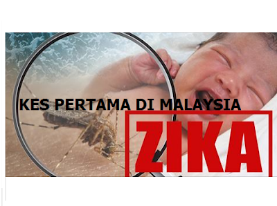 Virus Zika Negara