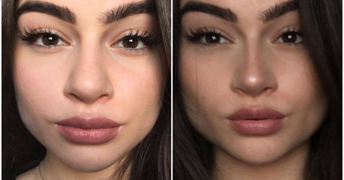 nose shapes nose shapes