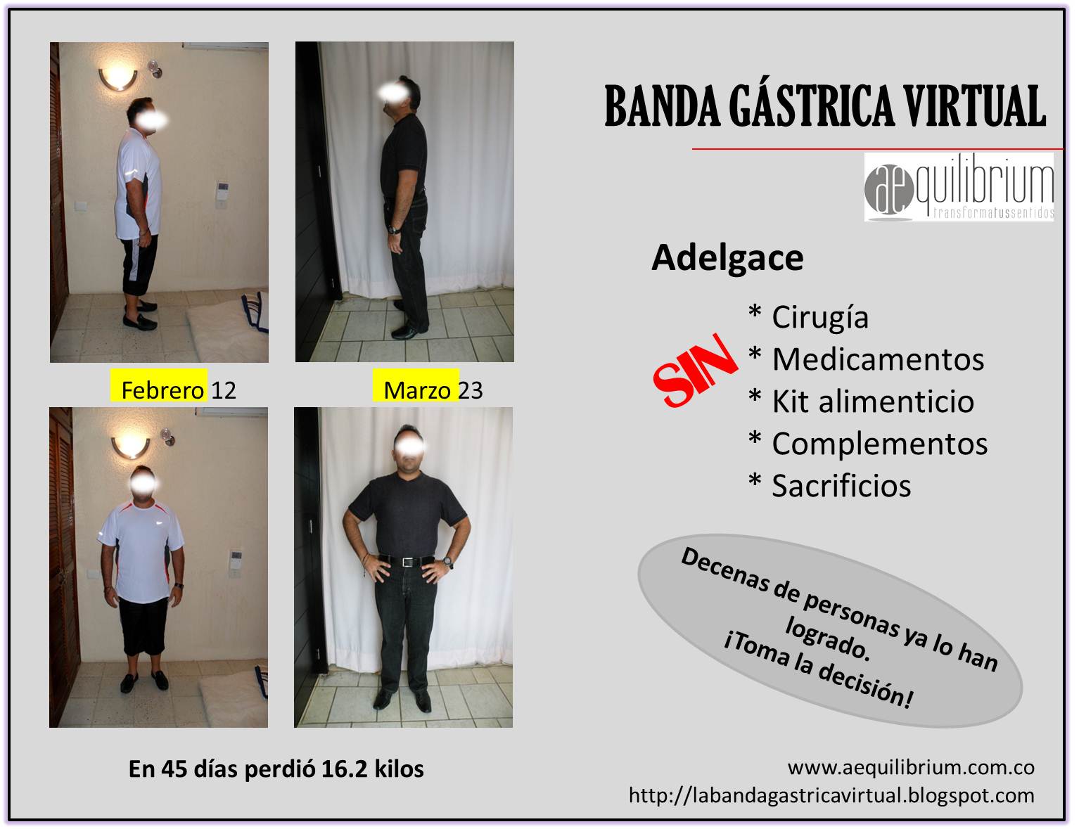 Banda Gástrica Virtual Aequilibrium