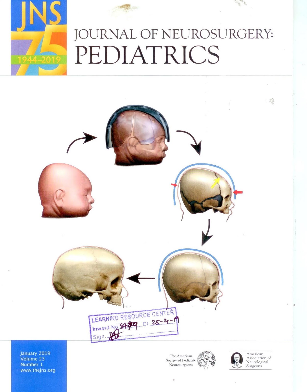 https://thejns.org/pediatrics/abstract/journals/j-neurosurg-pediatr/23/1/j-neurosurg-pediatr.23.issue-1.xml