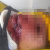 Barbaridade: Homem deixa mulher desfigurada após sessão de espancamento por causa de celular