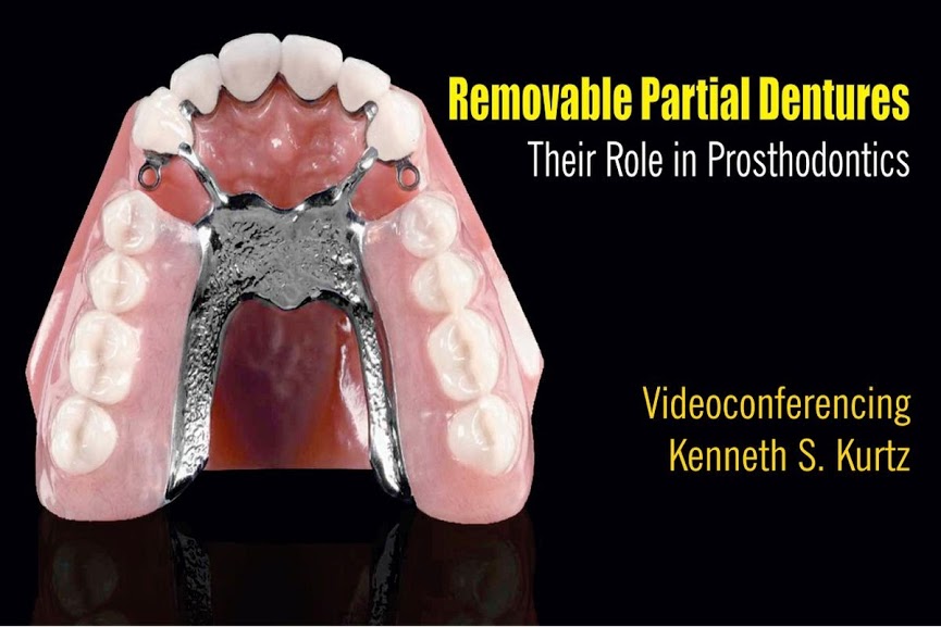 WEBINAR Removable Partial Dentures Their Role in Prosthodontics