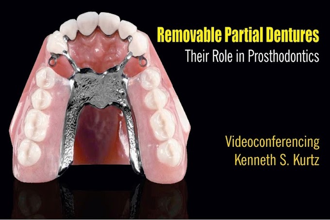 WEBINAR: Removable Partial Dentures - Their Role in Prosthodontics - Kenneth S. Kurtz