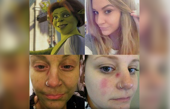 Salah Pakai Pemutih, Muka Wanita Ini Berubah Hijau Hampit Mirip Tokoh Fiona di Film Shrek