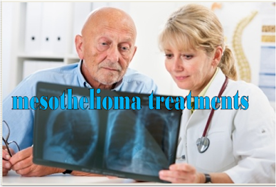 Mesothelioma malignancy is a hazardous illness and ought not be left untreated