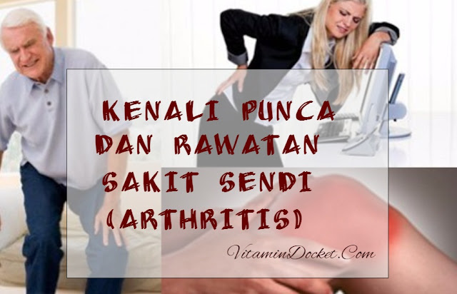  rawatan sakit sendi arthritis