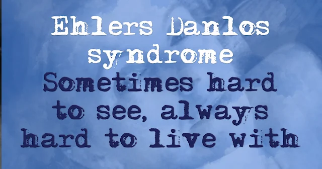Ehlers Danlos syndrome. Sometimes hard to see, always hard to love with