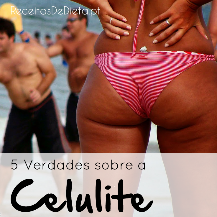 5 Verdades Sobre a Celulite