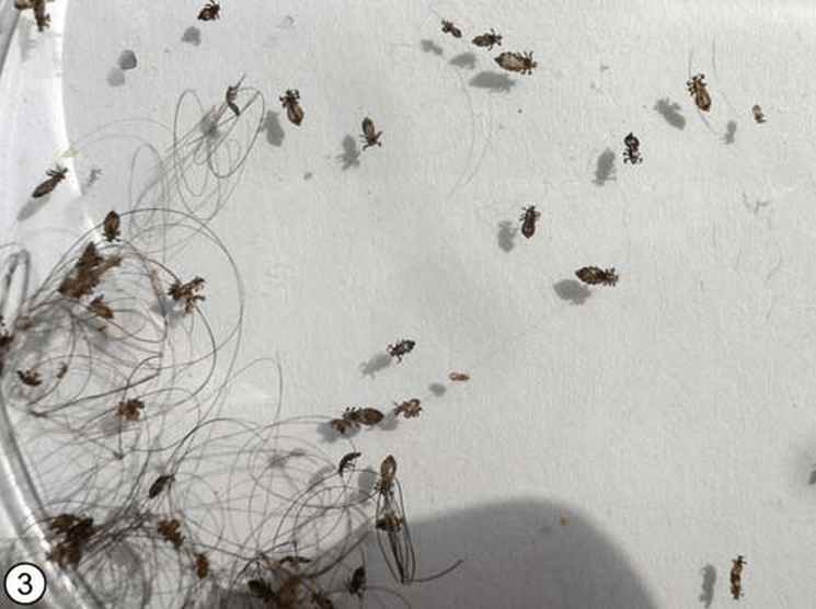 Dead Lice In Hair After Treatment Caraway Seeds Health Benefits
