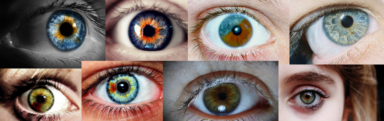 Несколько насколько. Гетерохромия Радужки глаз. Поликория и гетерохромия. Центральная гетерохромия радужной оболочки глаза. Гетерохромия карих глаз.