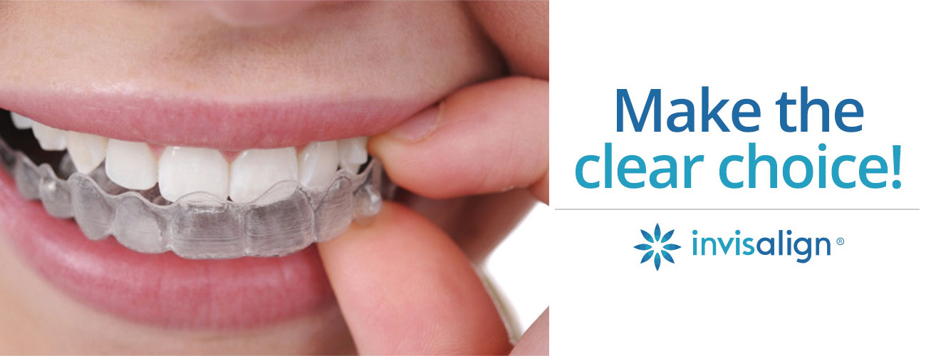 invisalign toronto dental choice clear provider markham braces orthodontist richmond hill play technology