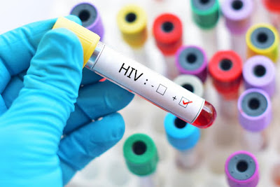 HIV Virus Can’t Hide Anymore | New Virus Detectives Test Shows Some Promises 