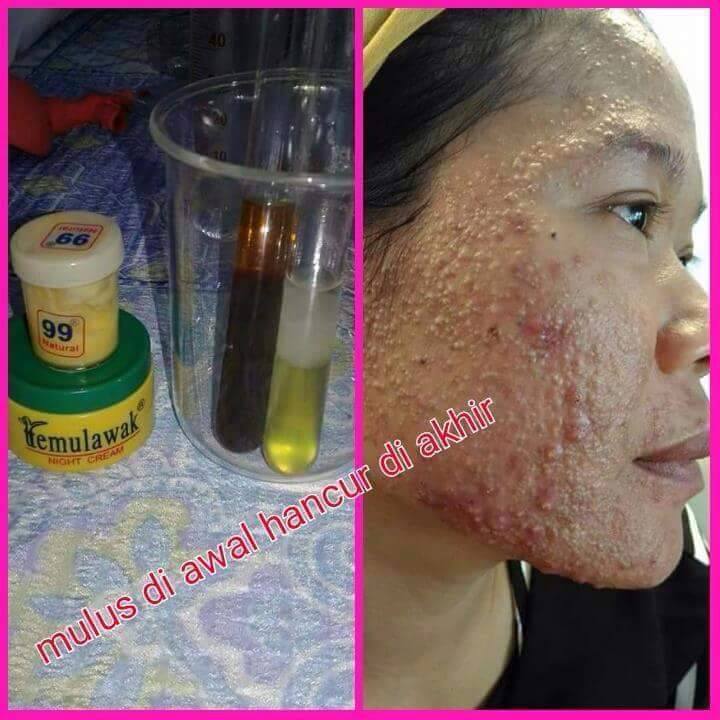 WASPADA CREAM WAJAH BERBAHAYA Skincare and Beyond by dr. ChanThai Land