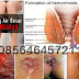 AmbeJOSS Zaitop Obat Wasir Berdarah di Apotik thumbnail