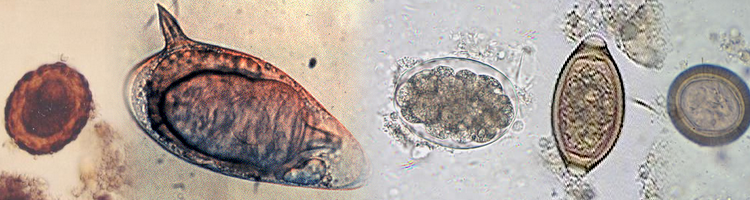 eozonofil paraziták