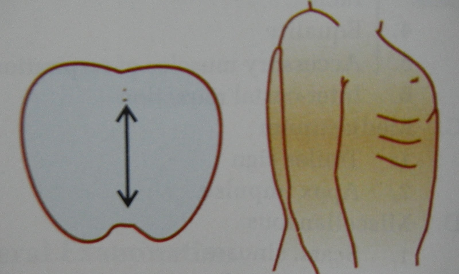 What Is Barrel Shape Chest? | Pectus Carinatum (Pigeon Chest) – EIZJO