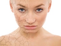Dry, cracked skin Problem Skin Types