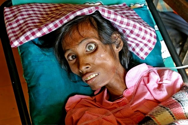 HIV/AIDS: The US Government Bio-Weapons Project For Global Depopulation