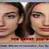 How Banish Your-Acne Mark | Gadgettech7