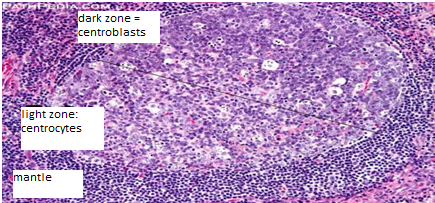 Pathology Cases: LN review