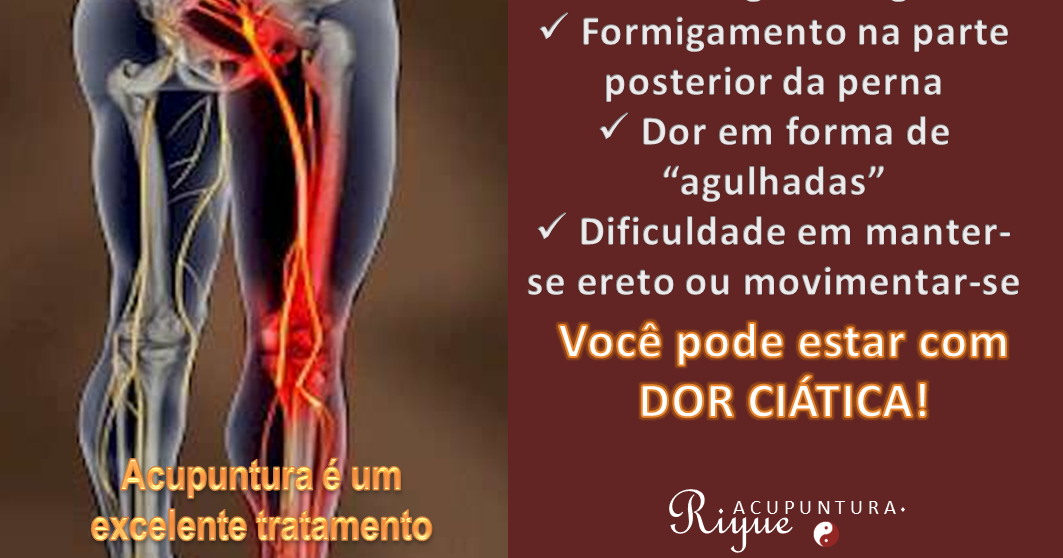 Riyue Terapias : A ACUPUNTURA NA DOR CIÁTICA