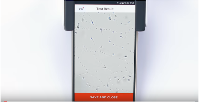 Yo Device : Live Motion Video Of Your Sperm Yo Device : Live Motion Video Of Your Sperm