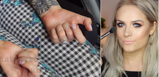 Beauty Vlogger Jordan Bone Just Revealed She's Partially Paralyzed