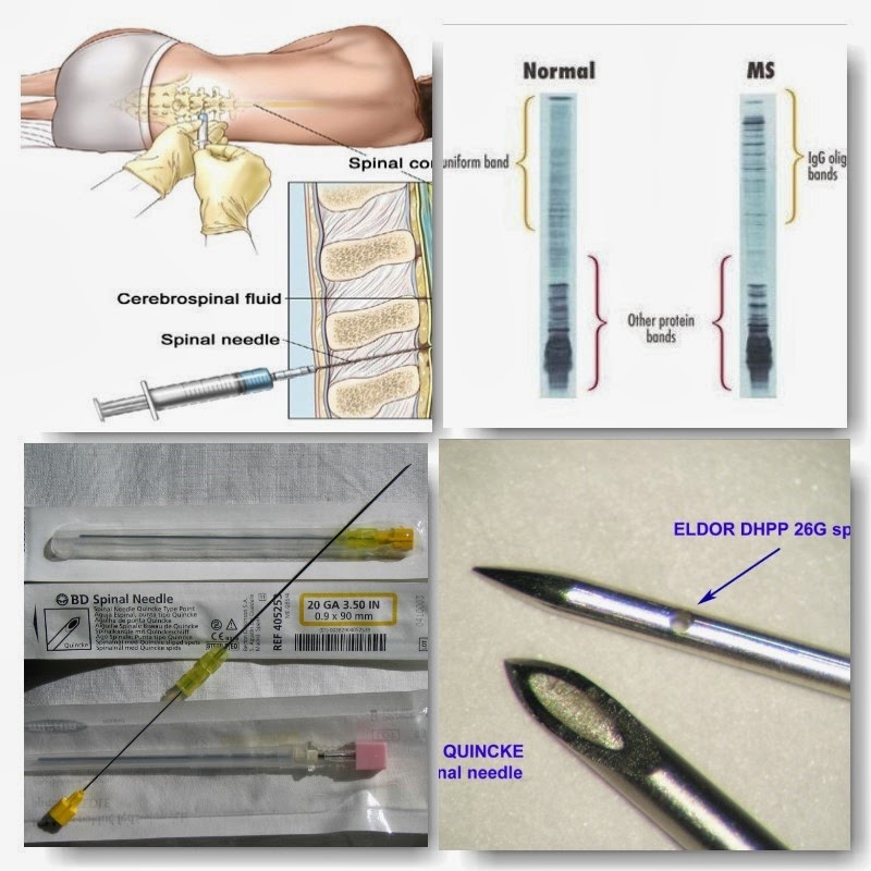 MS Brown (A Multiple Sclerosis Journey) "You're Going to Stick that