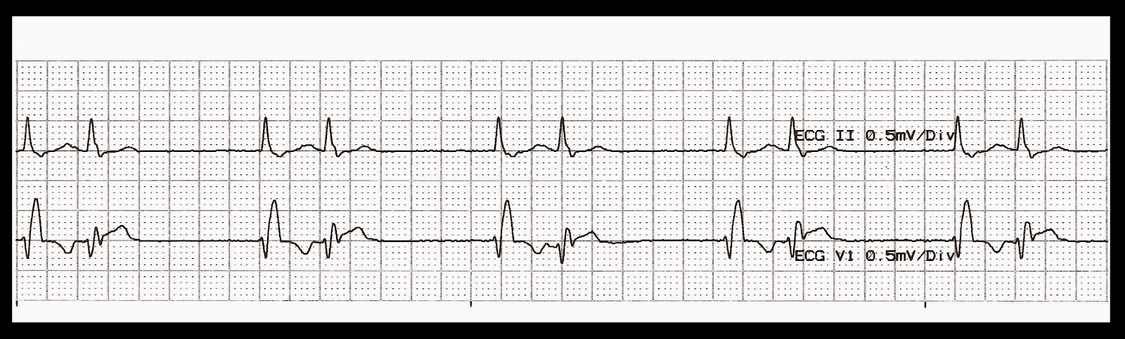 Practice EKG Strips 428