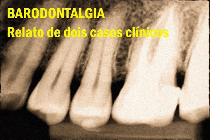 PDF: Barodontalgia: relato de dois casos clínicos