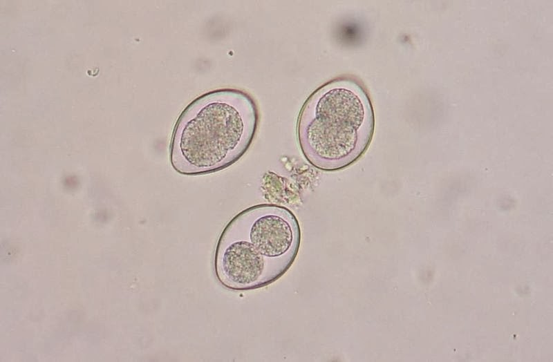 Image result for coccidia under microscope