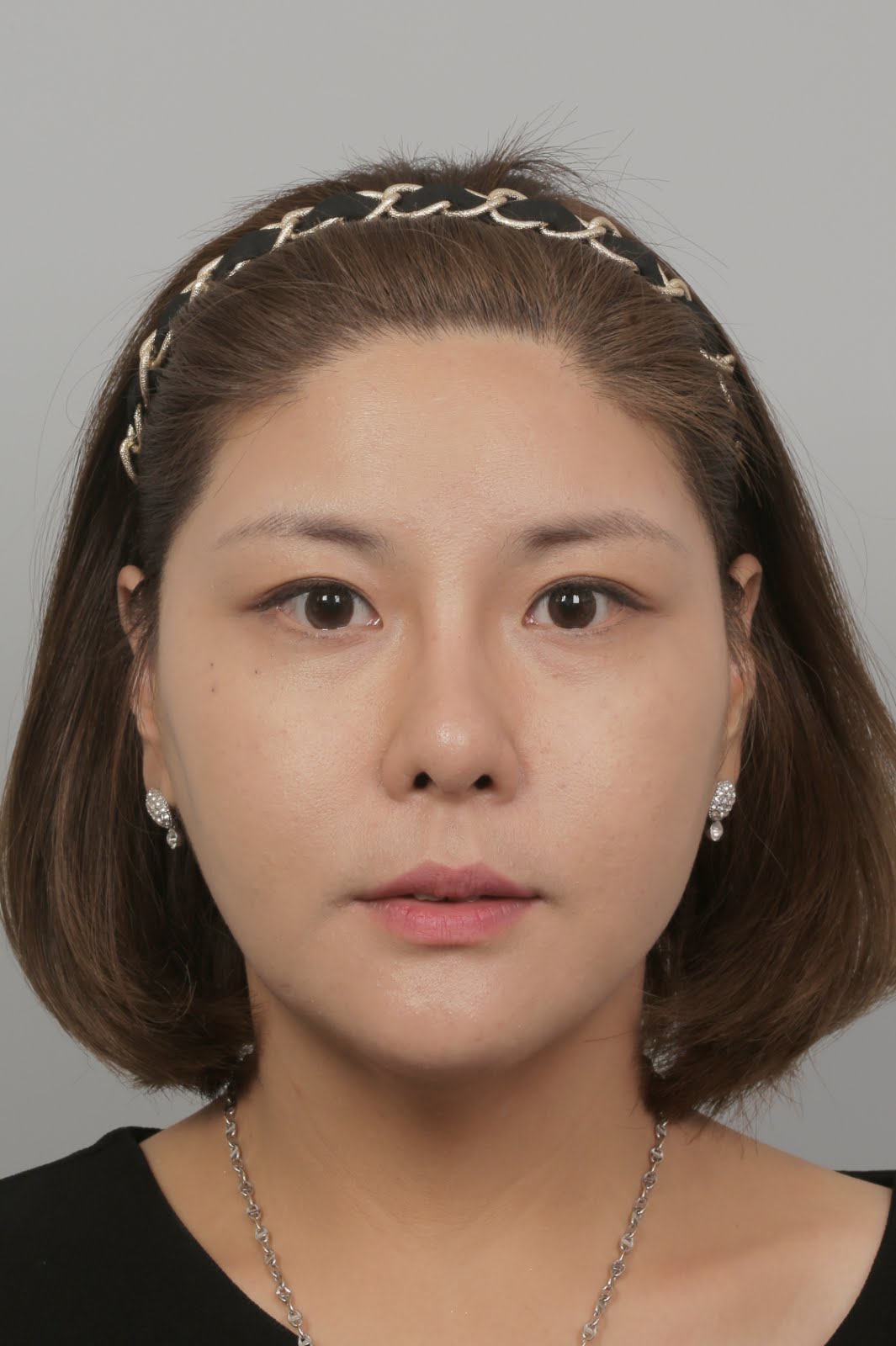 ID Hospital Korea [ID Hospital Korea Experiences] Anyone can have a