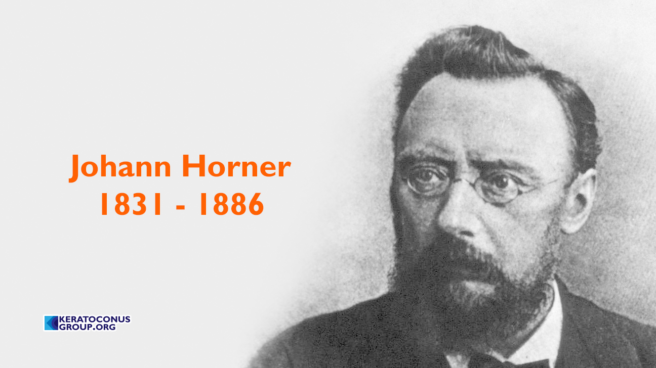 Johann Horner - On the treatment of keratoconus