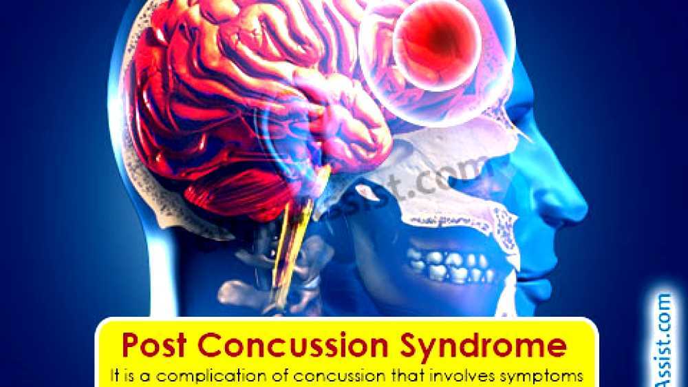 Postconcussion syndrome