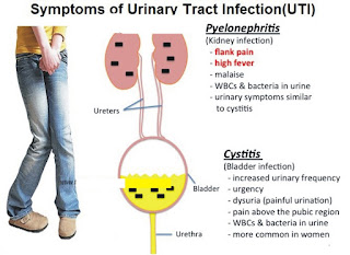 what causes frequent urination without pain what causes frequent urination without pain
