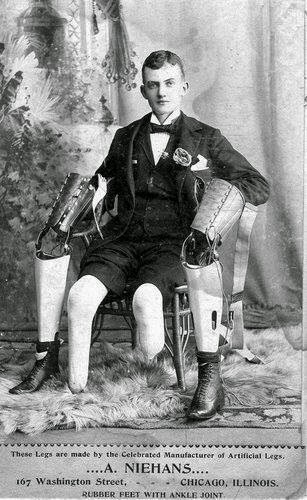 Vintage black and white photo of young man double leg amputee, seated, with his prosthetic legs off and displayed on either side of him