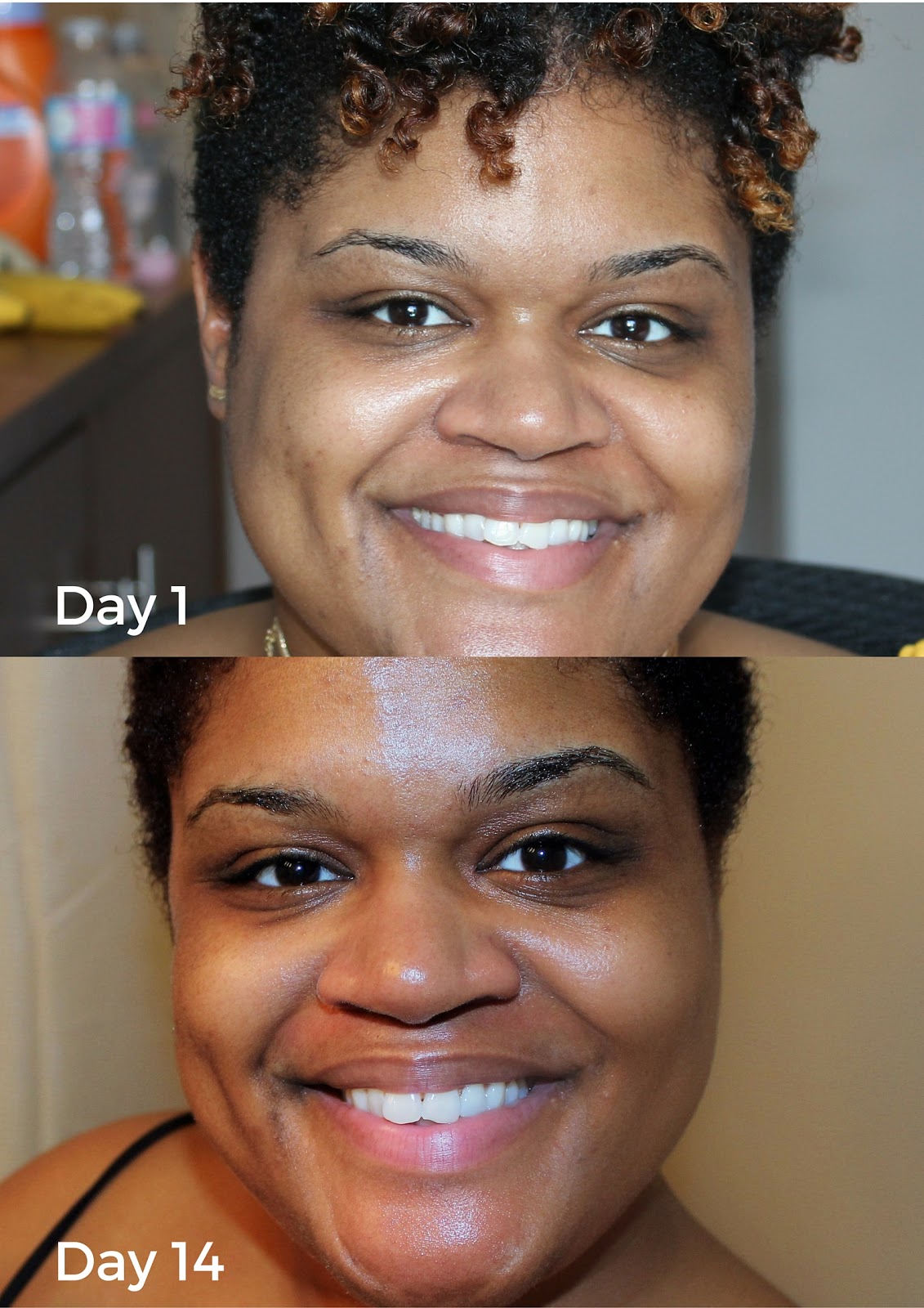 Three Ways Dove Beauty Bar Transformed My Skin in 14 Days + Giveaway