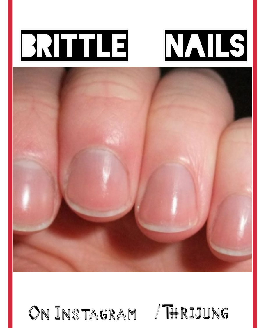 Five tips that nail say about your healthSee how(2019) Thrijung