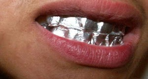 Savez-vous ce qui se passera si vous gardez de papier d'aluminium sur vos dents pendant 1 heure