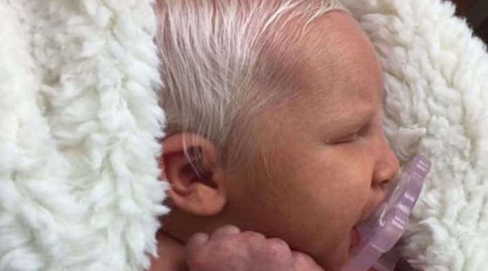 Baby Is Born With White Hair