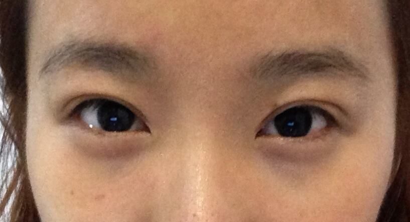Asian Eye Types 79