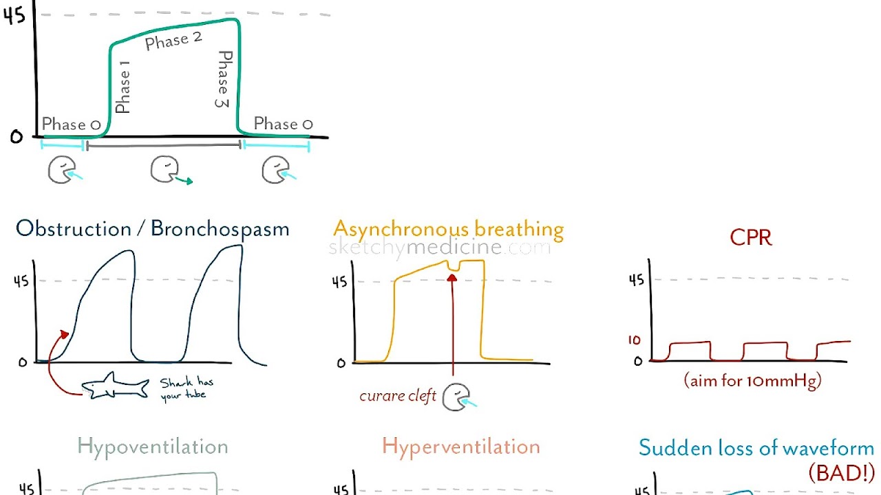 end tidal capnography end tidal capnography
