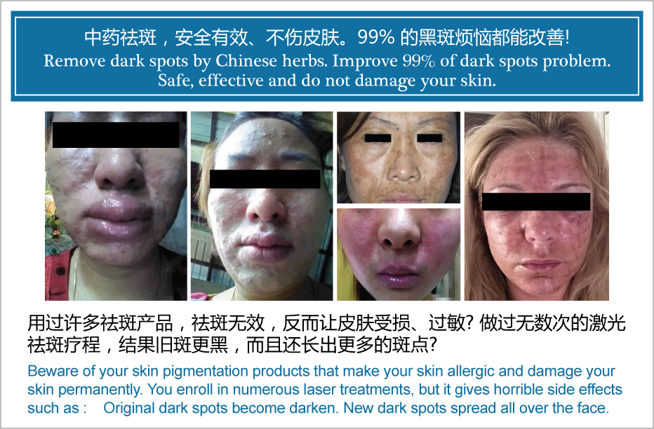 Ho Modesty Consultancy Acupuncture and Chinese herbs New Product