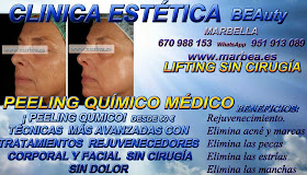 MARBELLA PEELING FACIAL QUIMICO MARBELLA PEELING FACIAL QUIMICO MEDICO PARA ELIMINACIÓN , QUITAR , TRATAMIENTO: ACNÉ , MARCAS , CICATRICES , MANCHAS ,PECAS , ESTRÍAS , MANCHAS