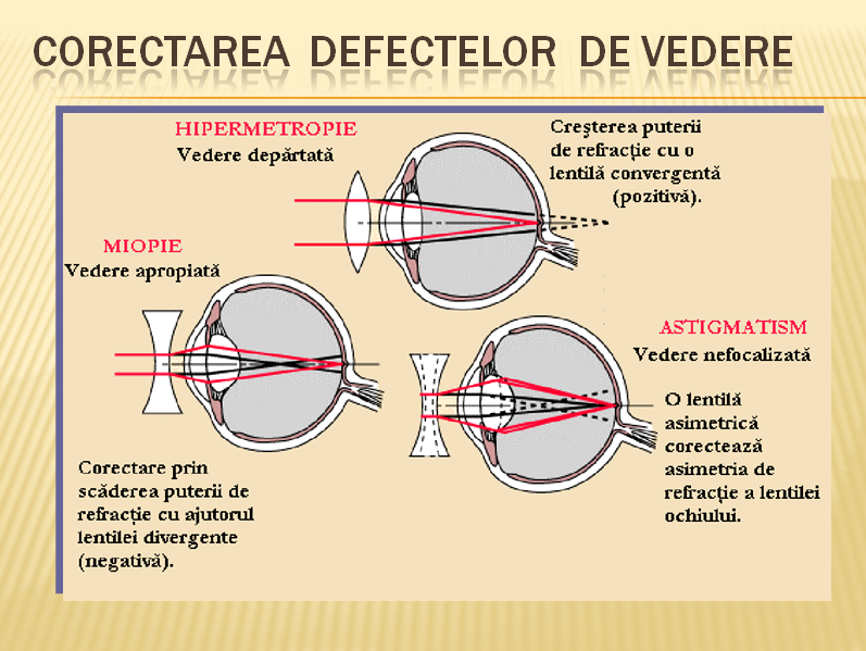 Corectarea Defectelor Vederii Cu Ajutorul Ochelarilor - Referate