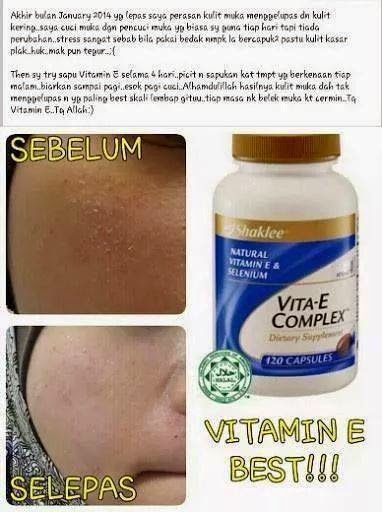 Testimoni vitamin E Shaklee untuk kulit