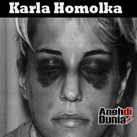 Mata Memar Karla Homolka.